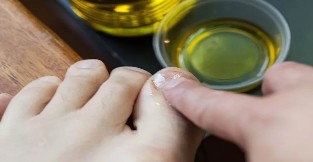 Aceites esenciais para loitar contra o lume